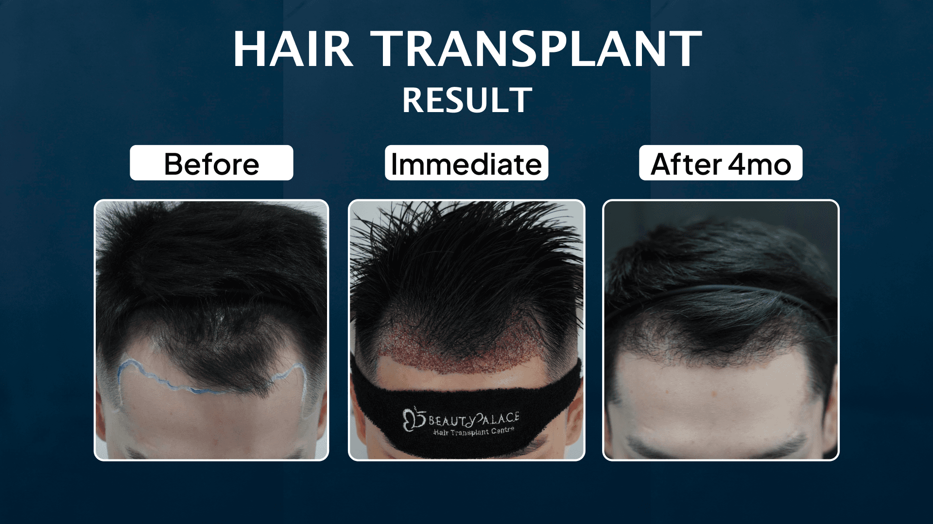 Hasil treatment ini nama